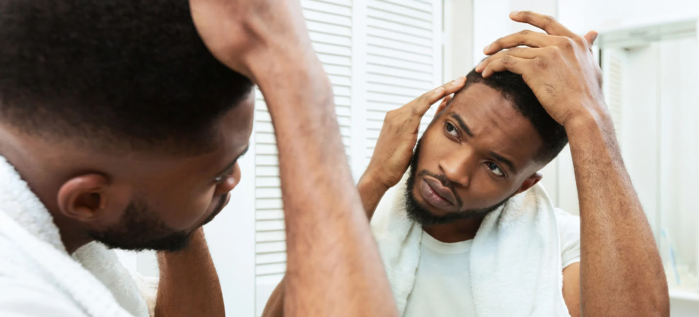 Fighting Male Hair Loss: Effective Treatment Strategies